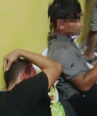 Korban Penganiayaan di Desa Batu Gajah Meminta Polres Kampar Tangkap Pelaku